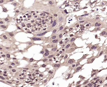 JMJD1B Rabbit Polyclonal Antibody