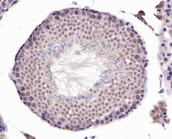 JMJD1B Rabbit Polyclonal Antibody