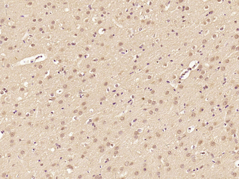 JMJD1B Rabbit Polyclonal Antibody