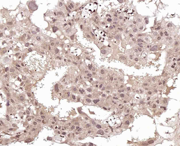 JMJD1B Rabbit Polyclonal Antibody