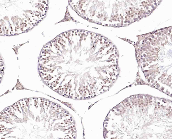 JMJD1B Rabbit Polyclonal Antibody