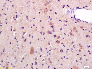 JNK2/MAPK9 Rabbit Polyclonal Antibody