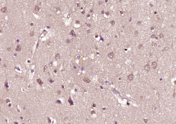 Phospho-MAPK8 (Thr183 + Tyr185) Rabbit Polyclonal Antibody