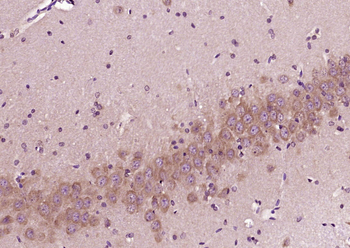 Phospho-MAPK8 (Thr183 + Tyr185) Rabbit Polyclonal Antibody