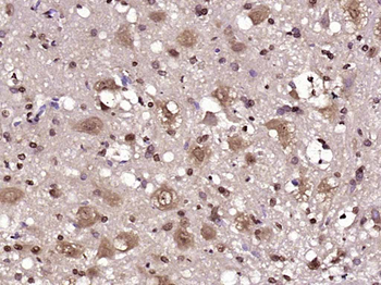 JNK1+JNK2+JNK3 Rabbit Polyclonal Antibody