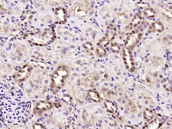 JNK1+JNK2+JNK3 Rabbit Polyclonal Antibody