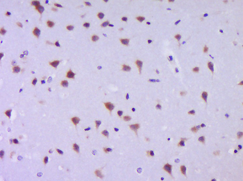 JNK1+JNK2+JNK3 Rabbit Polyclonal Antibody