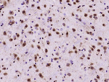JNK1+JNK2+JNK3 Rabbit Polyclonal Antibody