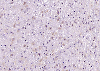 JNK1+JNK2+JNK3 Rabbit Polyclonal Antibody