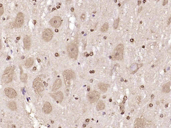 JNK1+JNK2+JNK3 Rabbit Polyclonal Antibody
