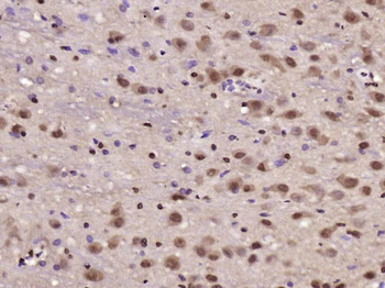 JNK1+JNK2+JNK3 Rabbit Polyclonal Antibody