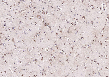KAT2B Rabbit Polyclonal Antibody