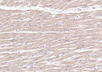 KAT2B Rabbit Polyclonal Antibody