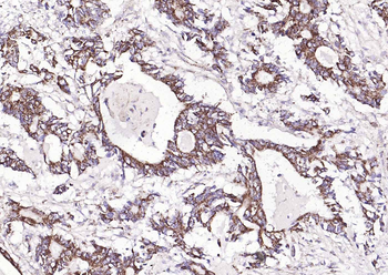 KAT2B Rabbit Polyclonal Antibody