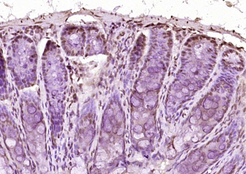 EP300 Rabbit Polyclonal Antibody