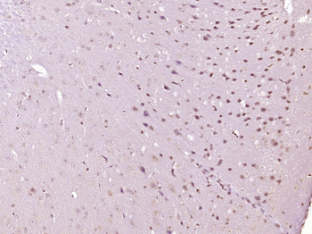 Phospho-EP300 (Ser1834) Rabbit Polyclonal Antibody