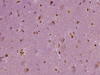 KEAP1 Rabbit Polyclonal Antibody
