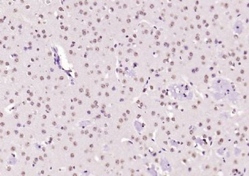 KEAP1 Rabbit Polyclonal Antibody