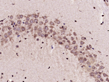 KEAP1 Rabbit Polyclonal Antibody