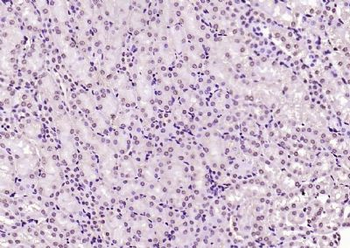 KEAP1 Rabbit Polyclonal Antibody