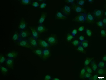 Phospho-KLF5 (Ser311) Rabbit Polyclonal Antibody