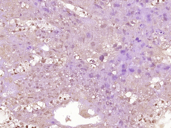 Phospho-KLF5 (Ser311) Rabbit Polyclonal Antibody