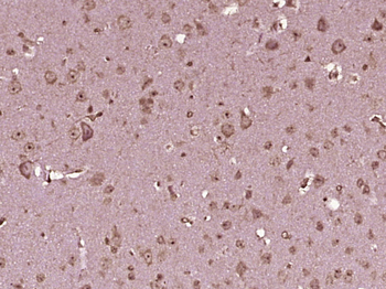 Mu Opioid receptor Rabbit Polyclonal Antibody