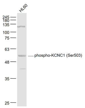 Phospho-KCNC1 (Ser503) Rabbit Polyclonal Antibody