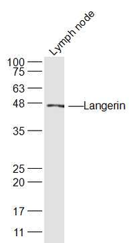 Langerin Rabbit Polyclonal Antibody