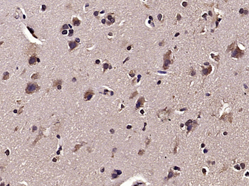 Phospho-STMN1 (Ser16) Rabbit Polyclonal Antibody