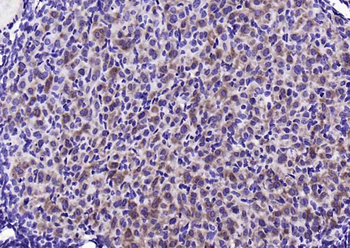 Phospho-STMN1 (Ser25) Rabbit Polyclonal Antibody