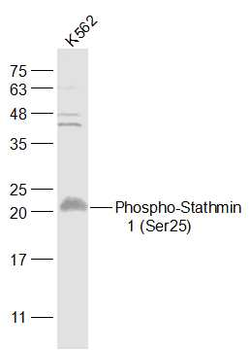 Phospho-STMN1 (Ser25) Rabbit Polyclonal Antibody