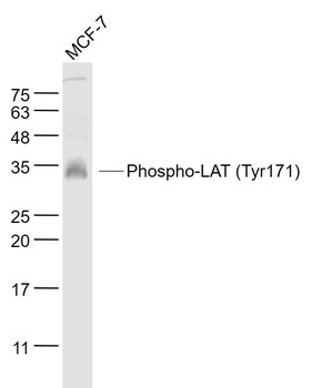 Phospho-LAT (Tyr171) Rabbit Polyclonal Antibody