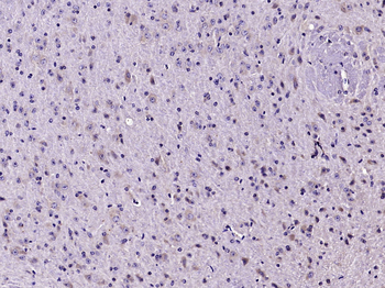 LC3B Rabbit Polyclonal Antibody