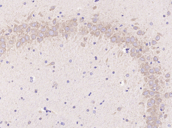 LC3B Rabbit Polyclonal Antibody