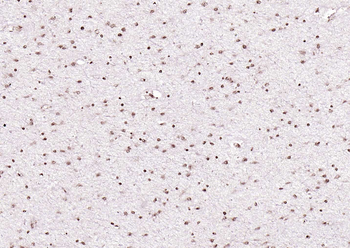LATS2 Rabbit Polyclonal Antibody