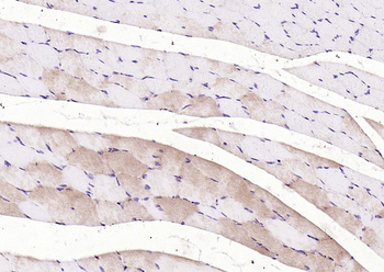 LATS2 Rabbit Polyclonal Antibody