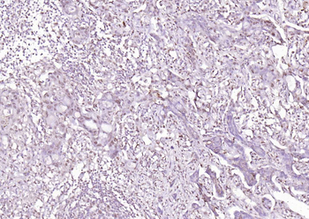 LATS2 Rabbit Polyclonal Antibody