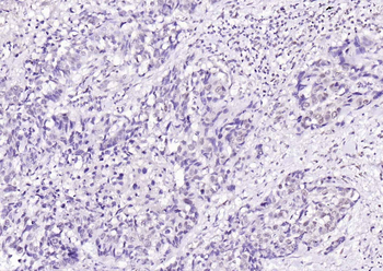 LATS2 Rabbit Polyclonal Antibody