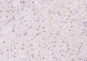 LATS2 Rabbit Polyclonal Antibody