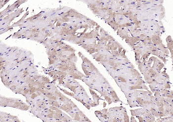 LATS2 Rabbit Polyclonal Antibody
