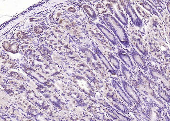 LATS2 Rabbit Polyclonal Antibody