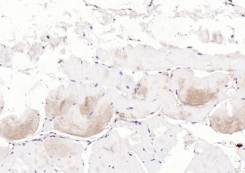 LATS2 Rabbit Polyclonal Antibody