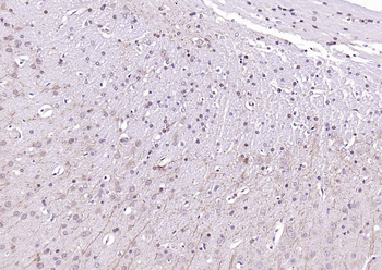 LATS2 Rabbit Polyclonal Antibody