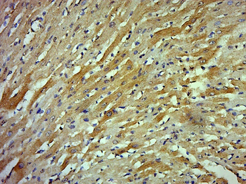 LATS2 Rabbit Polyclonal Antibody