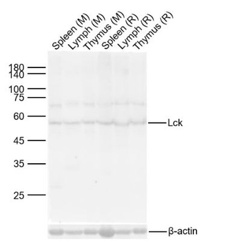 Lck Rabbit Polyclonal Antibody