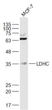 LDHC Rabbit Polyclonal Antibody