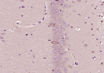 Leptin receptor Rabbit Polyclonal Antibody