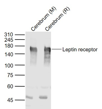 Leptin receptor Rabbit Polyclonal Antibody
