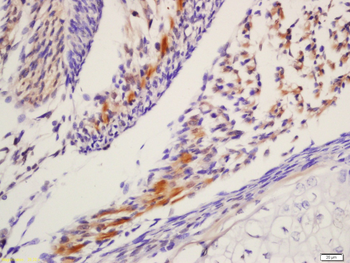 Leptin receptor Rabbit Polyclonal Antibody